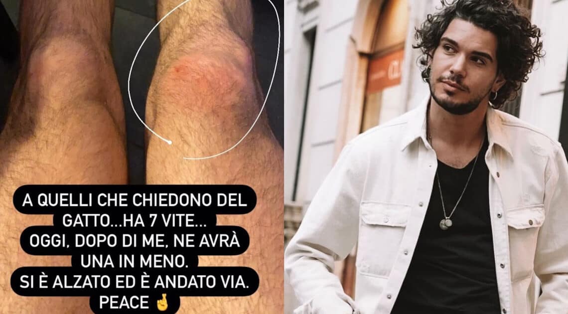 Uomini e Donne, l’ex tronista Gianluca De Matteis ha avuto un incidente: ecco le sue condizioni. Uomini e Donne, l’ex tronista Gianluca De Matteis ha avuto un incidente: ecco le sue condizioni.