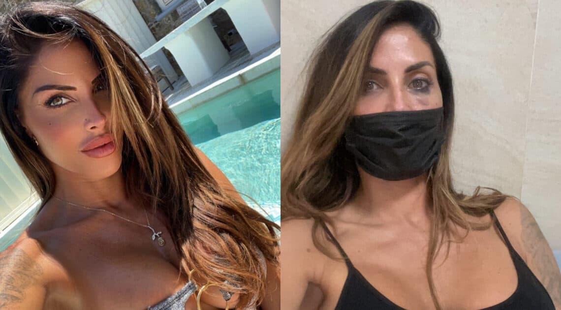 Guendalina Tavassi il volto tumefatto fa il giro del web, “Vergogna ridurre mia madre così” urla la figlia sul web Guendalina Tavassi il volto tumefatto fa il giro del web, “Vergogna ridurre mia madre così” urla la figlia sul web