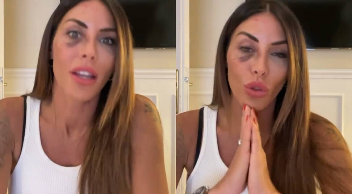 Guendalina Tavassi torna su Instagram dopo l’aggressione “Ho messo tutto in mano agli avvocati, non chiedetemi nulla” Guendalina Tavassi torna su Instagram dopo l’aggressione “Ho messo tutto in mano agli avvocati, non chiedetemi nulla”
