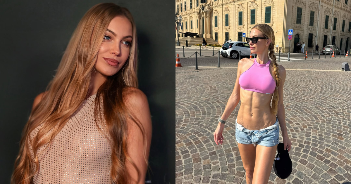 Taylor Mega svela il suo rapporto col botox: “Ho iniziato a 20 anni”